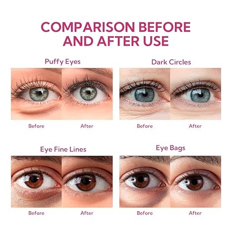 BREYLEE Rose Eye Mask– 60 Pcs, Under Eye Patches,Eye Patches For Puffy Eyes,Hydrates, Improves And Firms The Eye Area, Suitable For Both Women And Men.