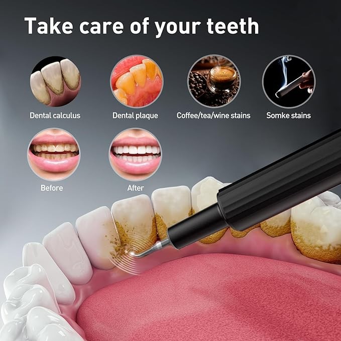Plaque Remover for Teeth - Tartar Remover for Teeth, Dental Calculus Remover Teeth Cleaning Kit，4 Speed Modes with 4 Replaceable Heads ，IPX6 Waterproof with LED Light
