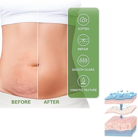 BEENOUR Heal Scar Care Spray - Advanced Formula for All Types of Scars (80g)